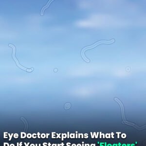 Eye Doctor Explains What To Do If You Start Seeing ‘Floaters’