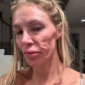 Sad truth about Brandi Glanville’s face
